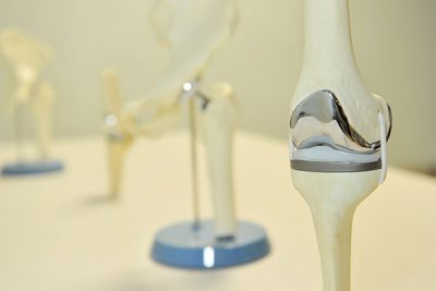 UNC Cary Orthopaedics | Cary, Raleigh & the Triangle Area