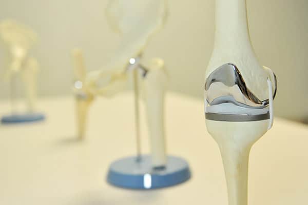 What is a Total Hip Replacement? - Cary Orthopaedics