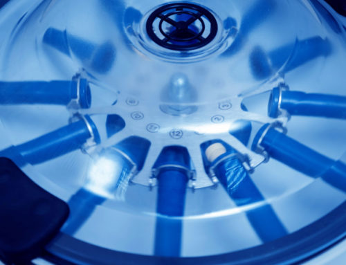 PRP Injections to Help Alleviate Joint Pain