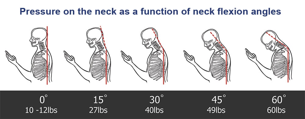 Posture Matters: Back and Neck Pain
