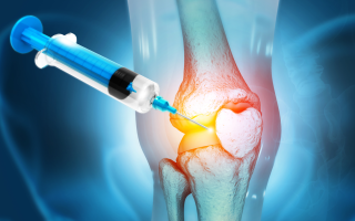 illustrations of regenerative orthopedics knee injection