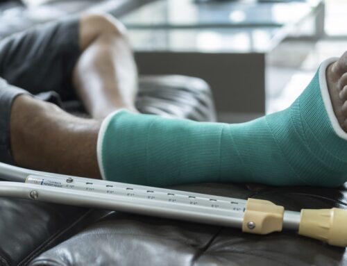 Bone Fractures – From Diagnosis to Recovery