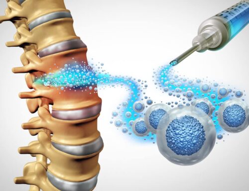 Conditions Treated With Orthopedic Stem Cell Therapy at Cary Orthopedics