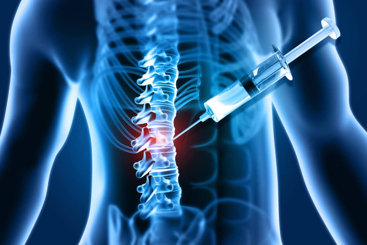 How an Injection in the Spine Can Help Treat a Prolapsed Disc