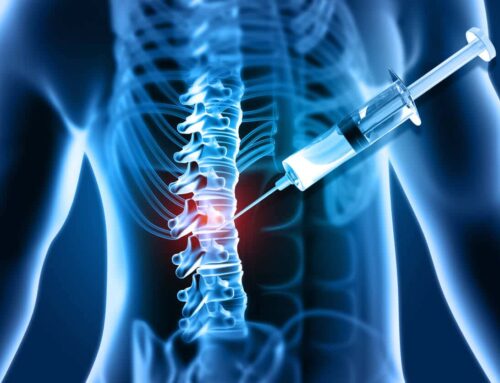 How an Injection in the Spine Can Help Treat a Prolapsed Disc