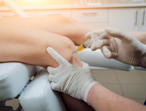 How PRP Treatment for the Knee Can Help You Avoid Surgery