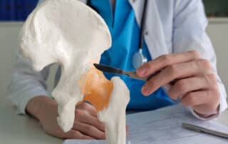 A doctor holds a scalpel while explaining Hip replacement surgery to a patient.