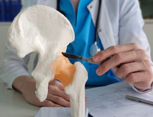How Do I Find Hip Replacement Surgeons?
