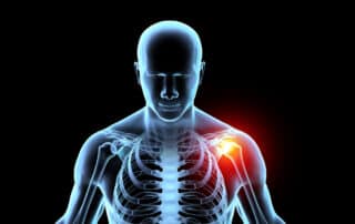 3D Image illustration of a person's upper skeleton with shoulder joint pain.