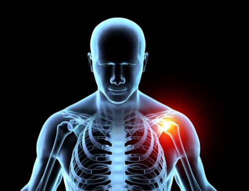 Is Shoulder Replacement Surgery Right for Me?