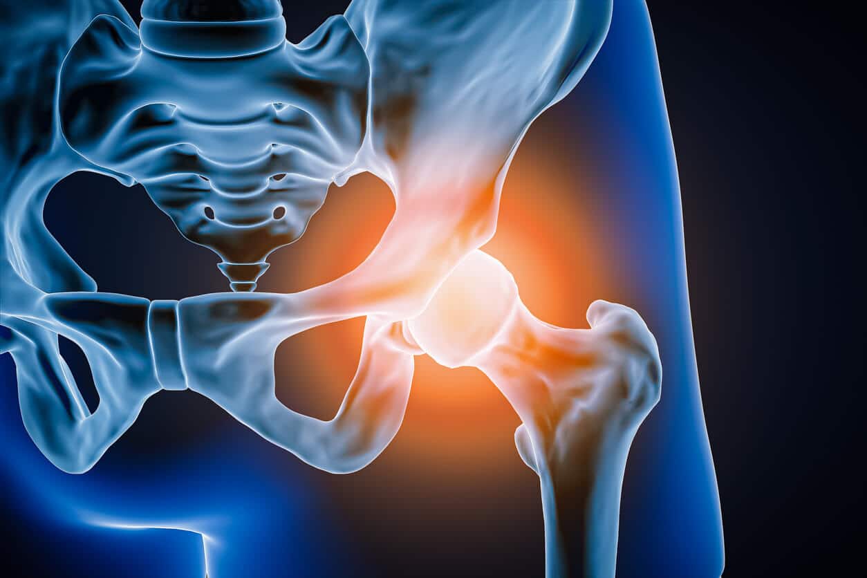 Front-facing (anterior) view of the human hip joint and surrounding bones, depicted as a 3D-rendered illustration highlighting inflammation or injury.
