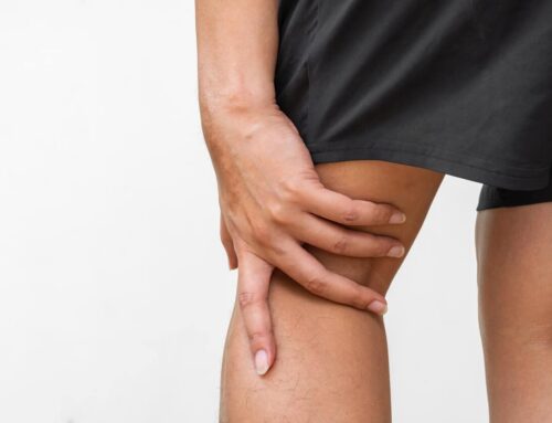 Can Urgent Care Centers Treat Sprains?