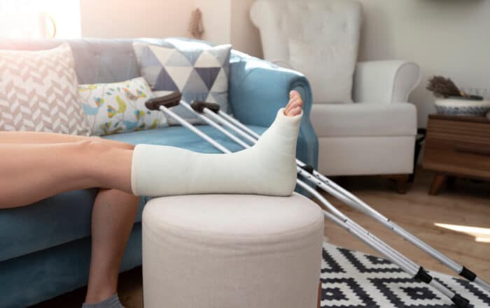 Image of a person with broken ankle and a leg cast.