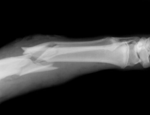 Is Urgent Care Best for Broken Bones?