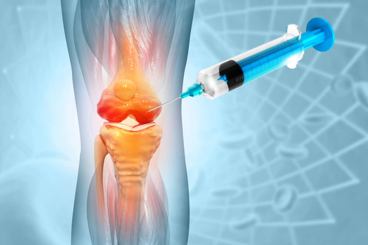 3d illustration of stem cell therapy for arthritis pain in the knee.