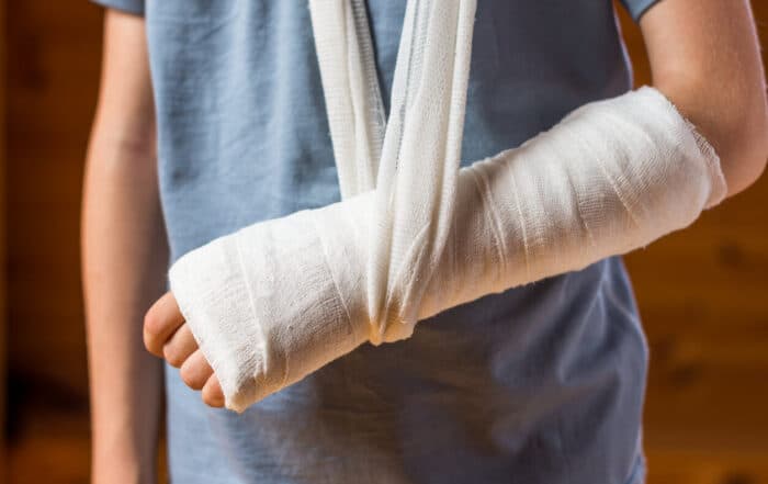 Boy with bone fracture with arm in plaster.