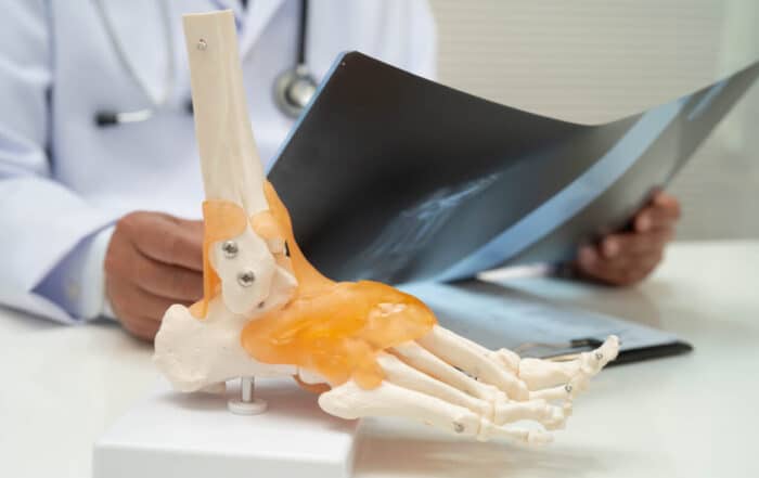 Doctor examining foot ankle joint bone radiography xray film.